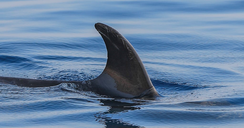 Le mari de la Québécoise qui s'est fait arracher les mains par un requin brise le silence