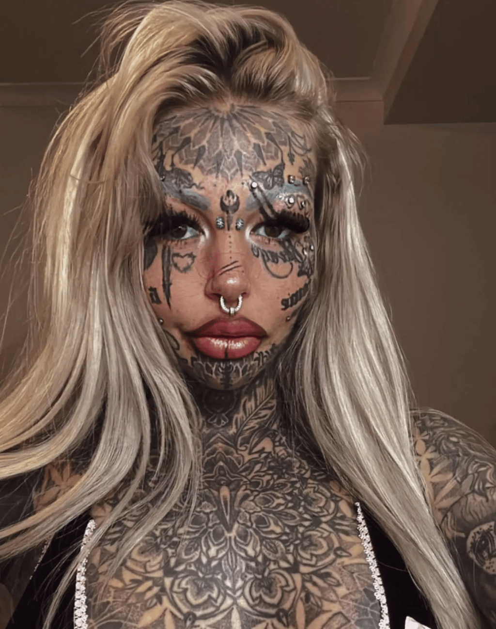Une femme qui avait perdu la vue à la suite d'un tatouage dans l'oeil se fait tatouer à nouveau au même endroit.