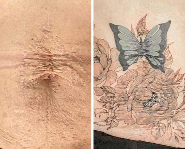 Deux tatoueuses métamorphosent des cicatrices en véritables oeuvres d’art