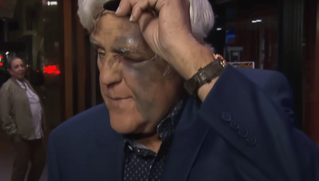 Le célèbre animateur Jay Leno sérieusement blessé après fait une vilaine chute