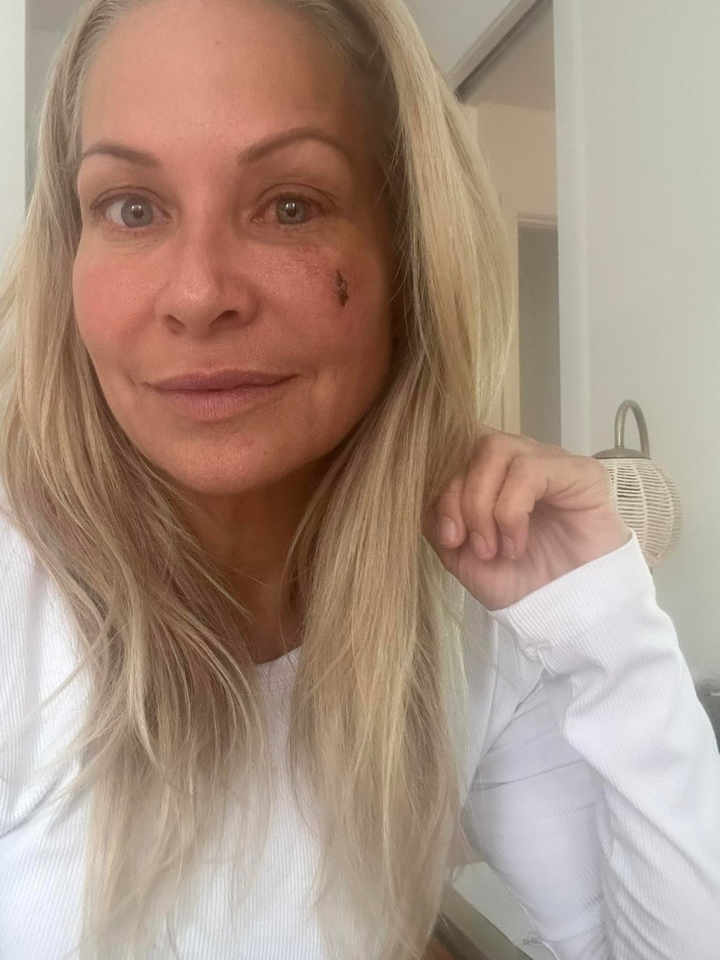 Katherine Huet atteinte de graves séquelles après sa blessure à survivor québec
