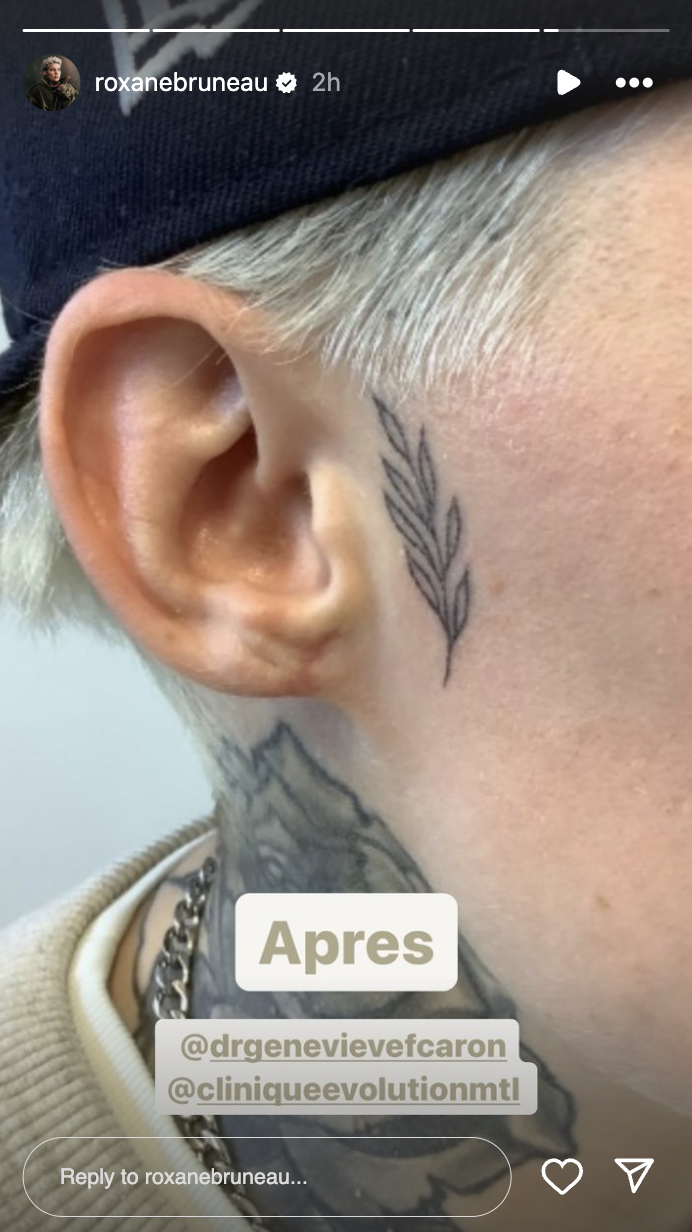 Roxane Bruneau partage le résultat de son opération aux oreilles