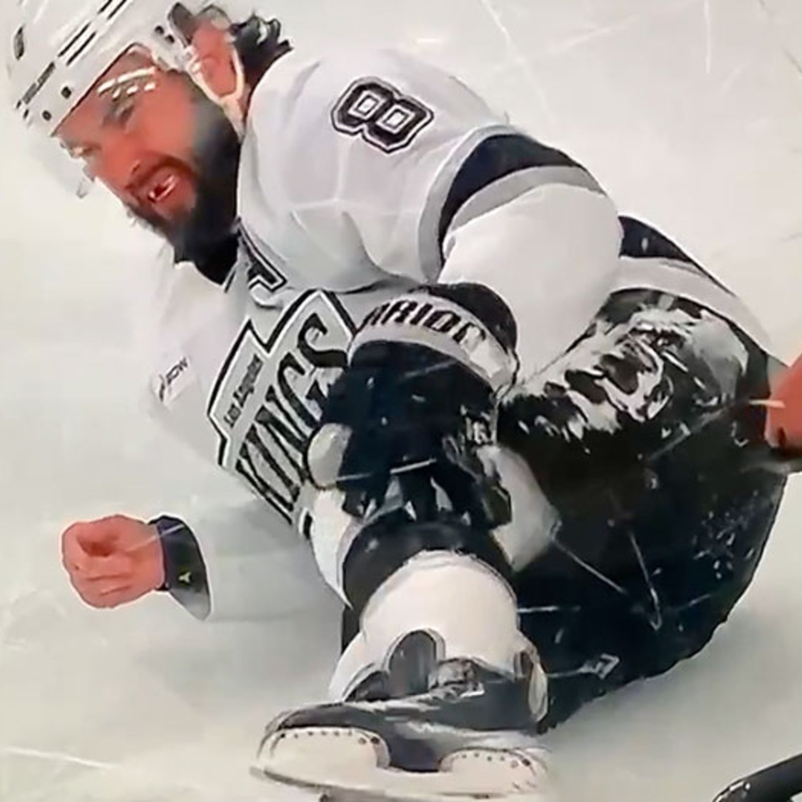 Doughty suffers a devastating injury last night