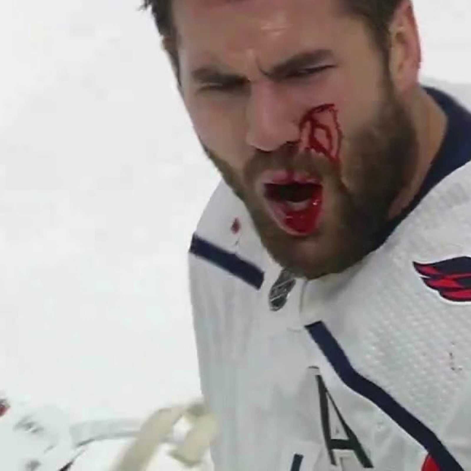 Tom Wilson still blowing blood out of his nose ahead of tomorrow’s game