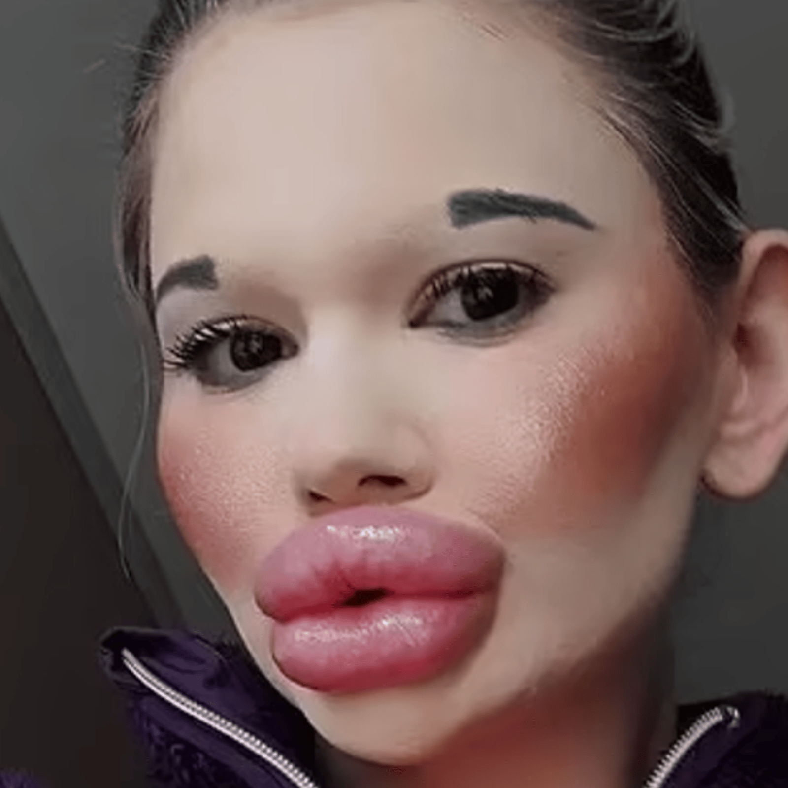 La femme aux plus grosses lèvres du monde veut désormais les pommettes les plus imposantes