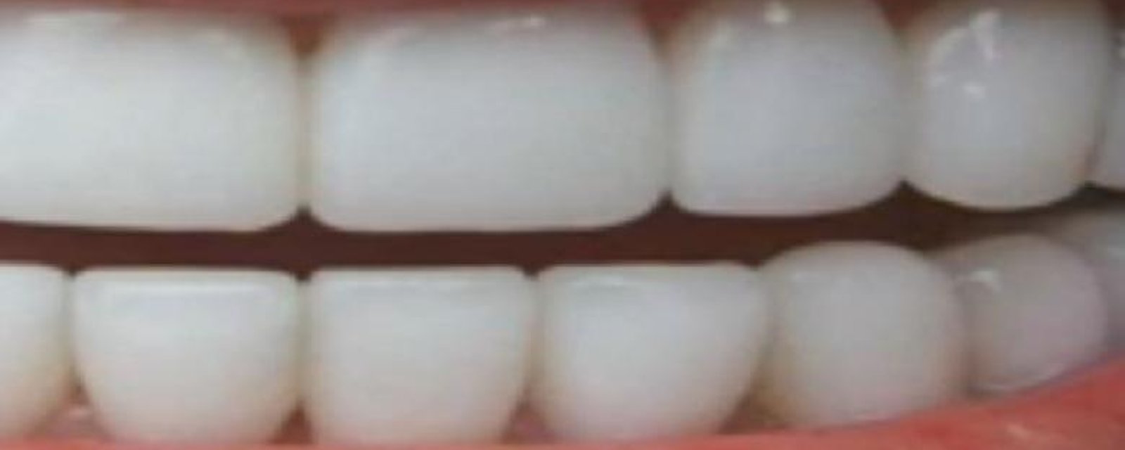 Comment avoir des dents plus blanches en 3 minutes