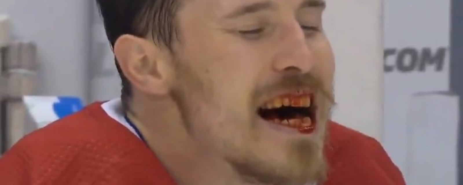 Un scan est prévu pour Brendan Gallagher cet après-midi