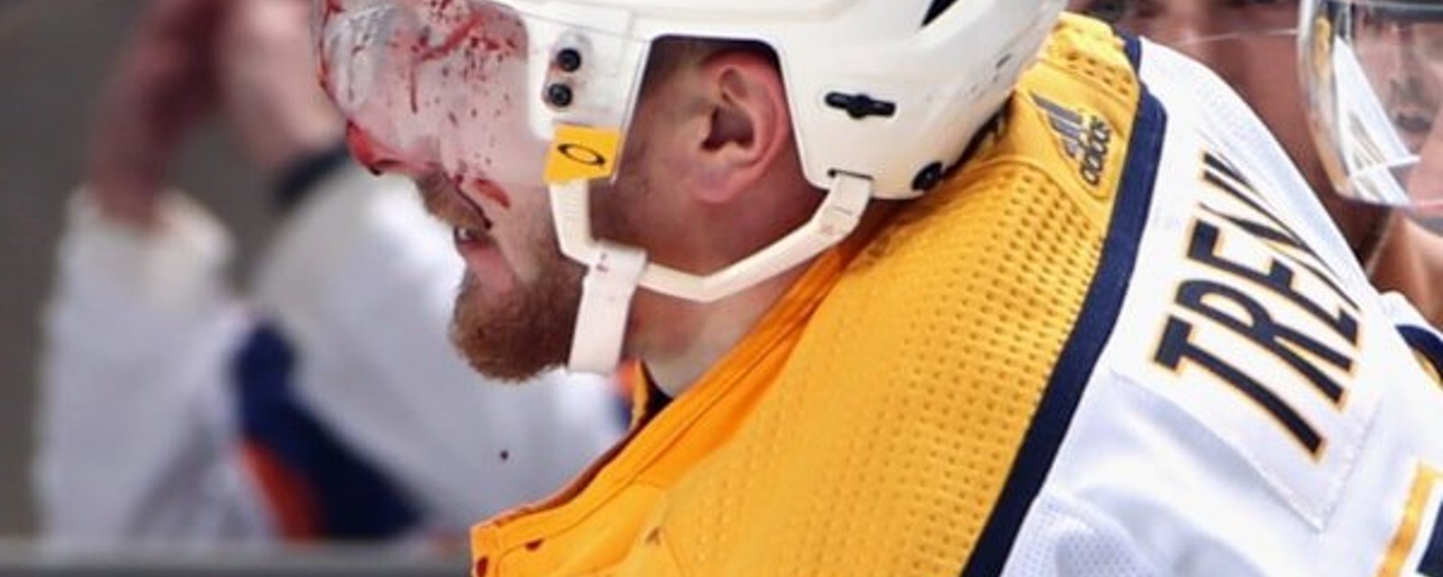 Zdeno Chara venge son coéquipier et défigure un joueur des Preds!