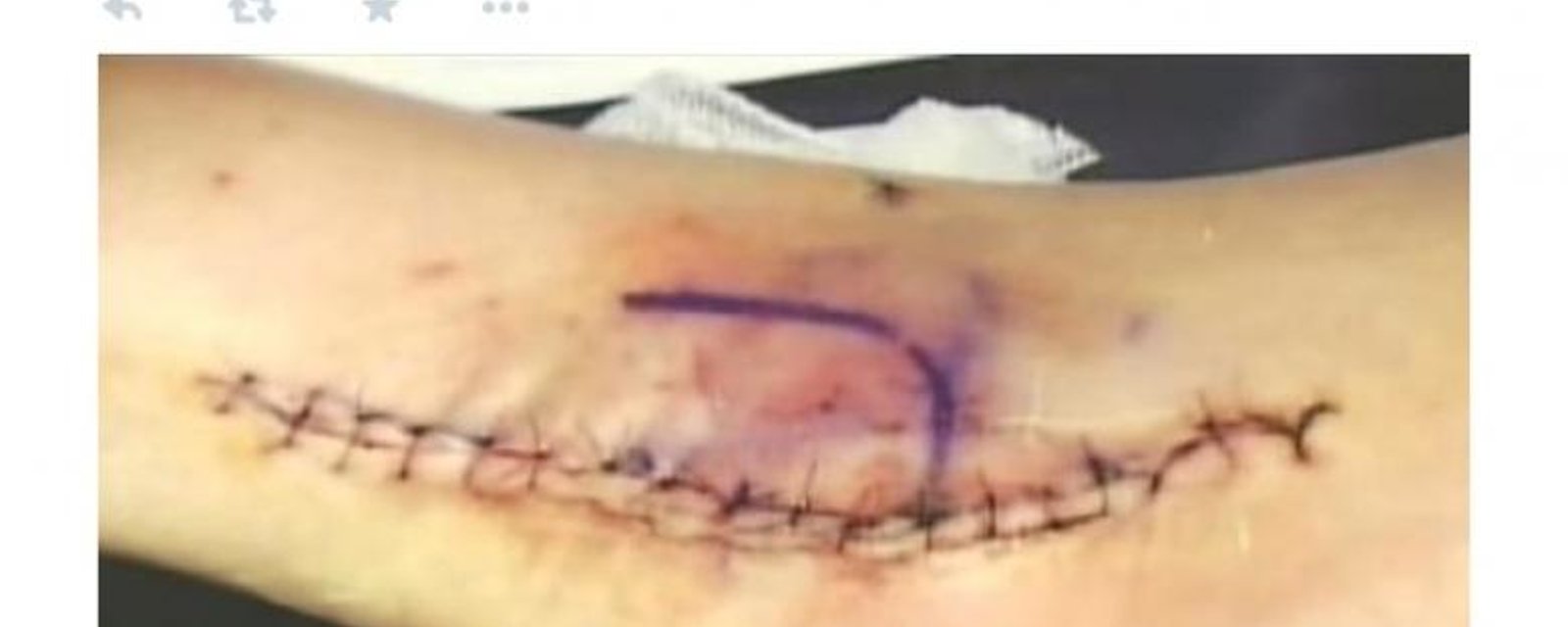 Curt Schilling tweets ghastly photo of &amp;quot;Bloody Sock&amp;quot; ankle. (PHOTOS)