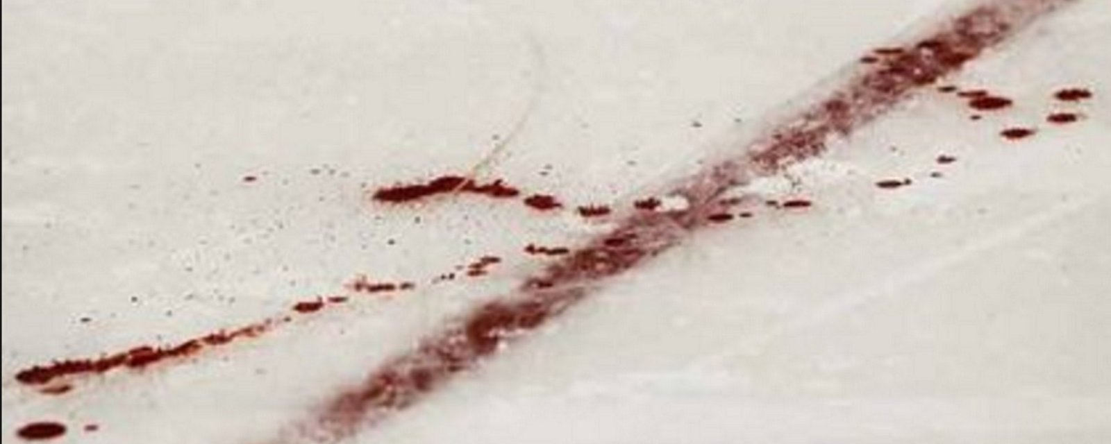 NHL forward leaves a trail of blood as he rushes off the ice with a nasty cut.