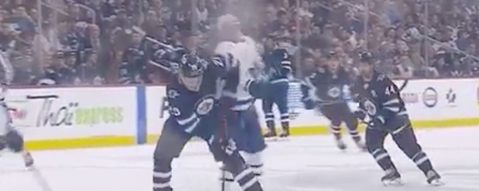 Leafs losing Mitch Marner to concussion?! 