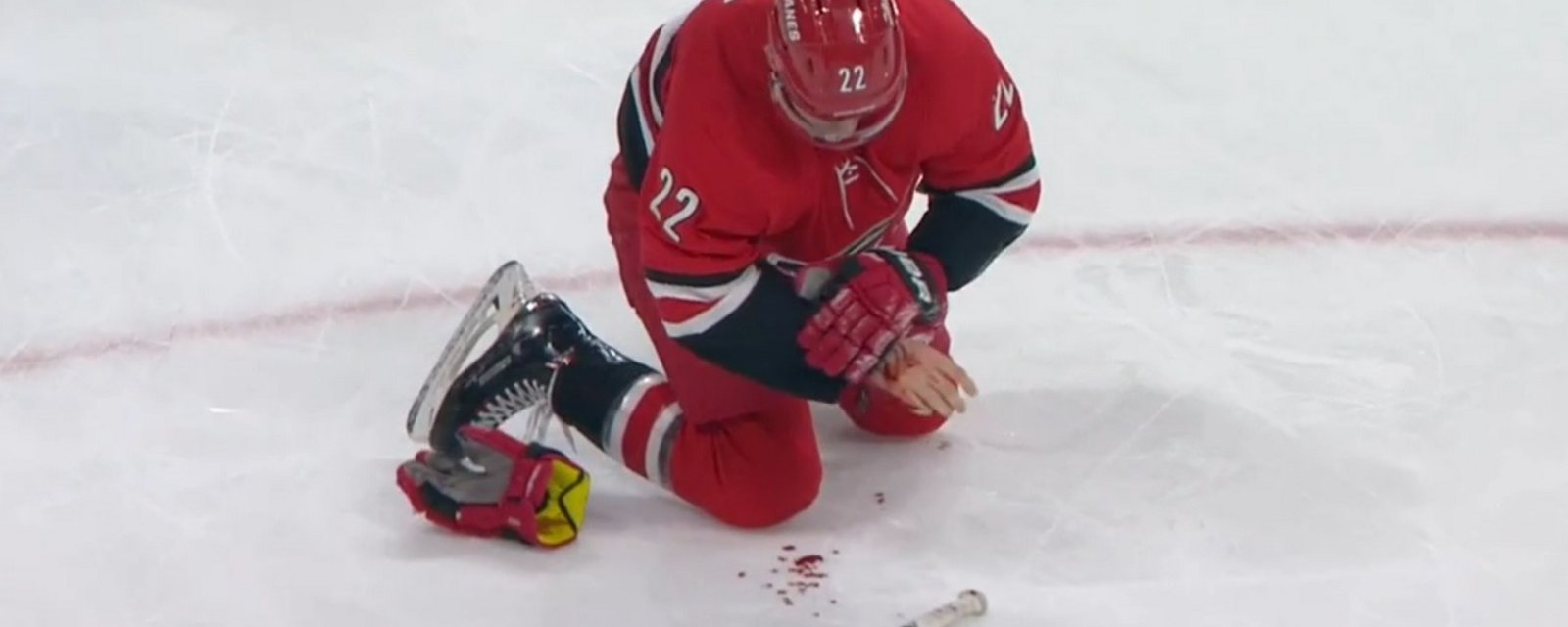 Brett Pesce left bleeding all over the ice after blocking a shot.