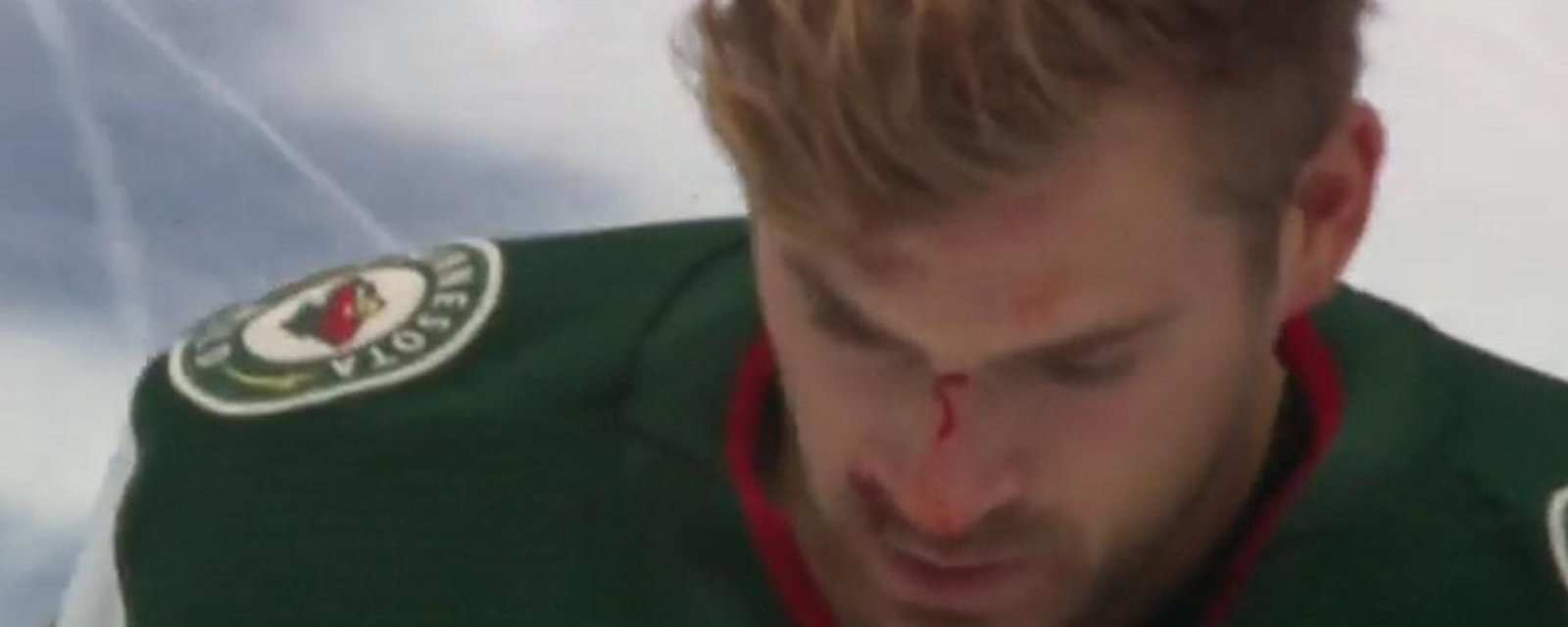 Foligno and Ferland trade some big bombs in the opening minutes of Game 1.