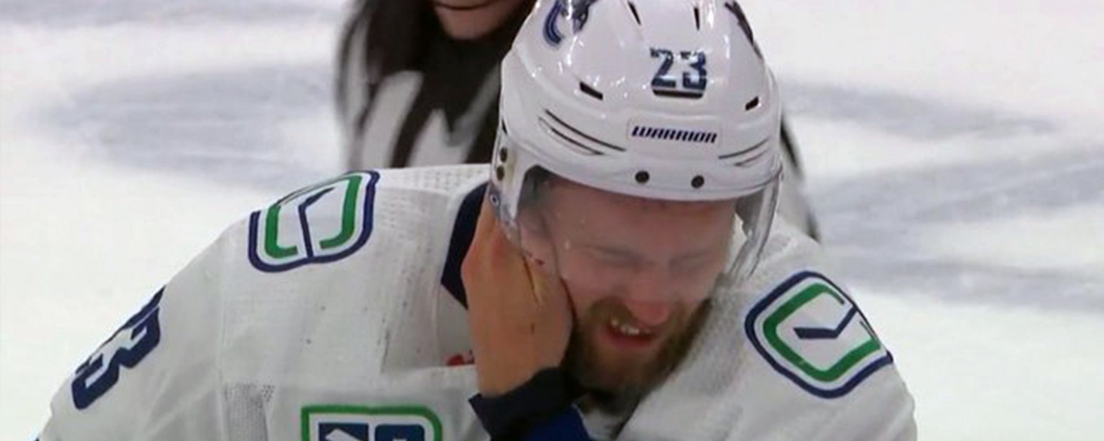 Alex Edler suffers gruesome skate blade cut to his head