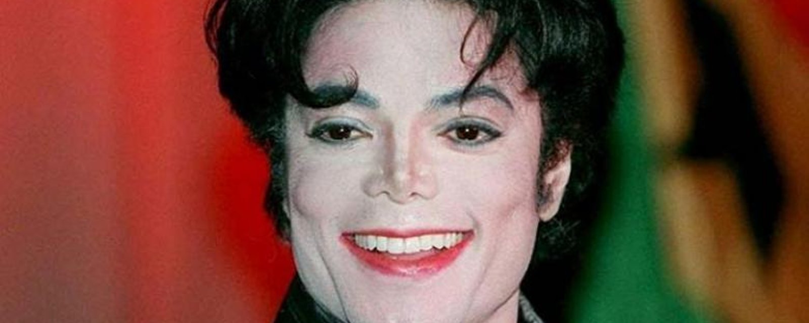 Le chat Michael Jackson souffre de la même maladie que lui... Et il est de toute beauté!