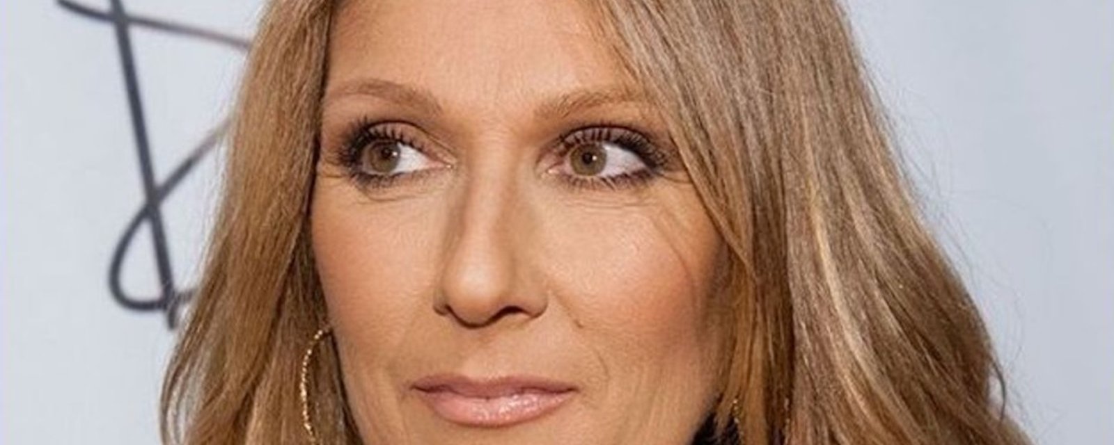 Céline Dion révèle ses secrets de chirurgies esthétiques