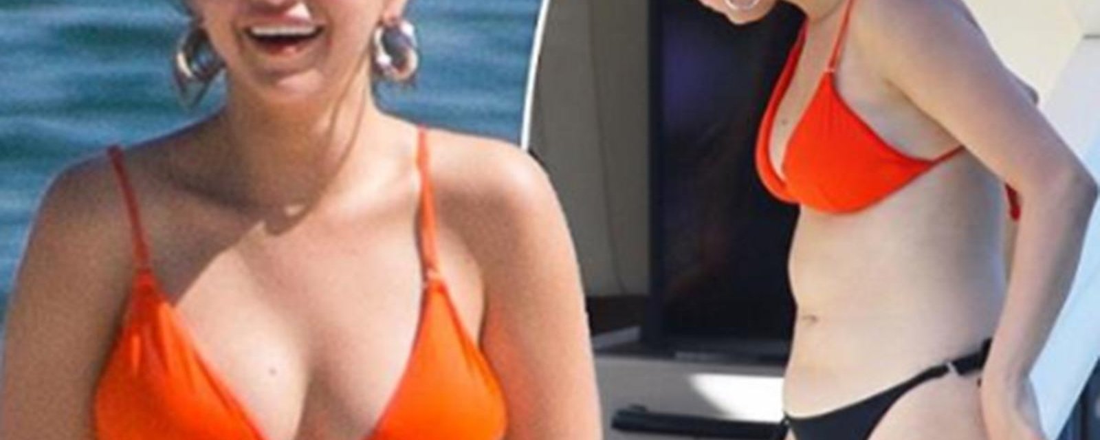 Selena Gomez s'affiche en bikini et ne cache pas son énorme cicatrice après une deuxième intervention chirurgicale 