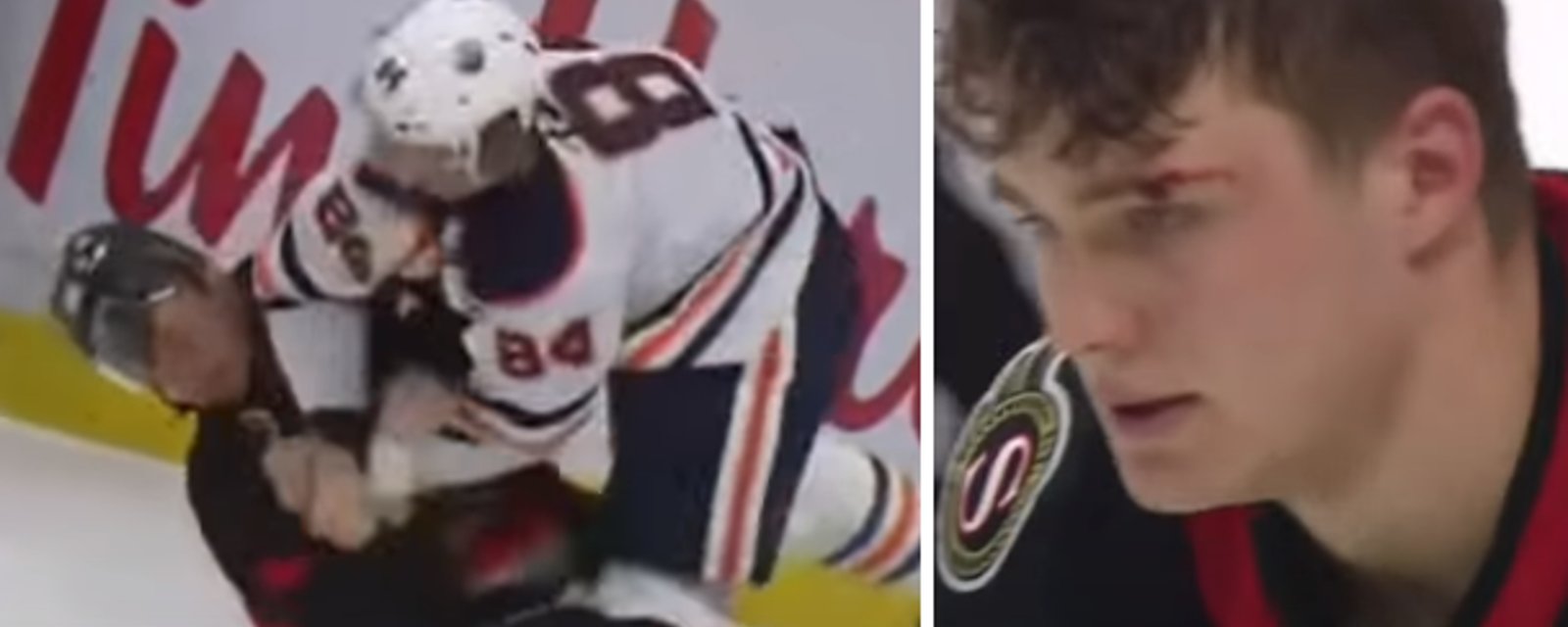 VIDÉO | Tim Stützle reçoit un violent coup au visage lors de son premier combat dans la LNH