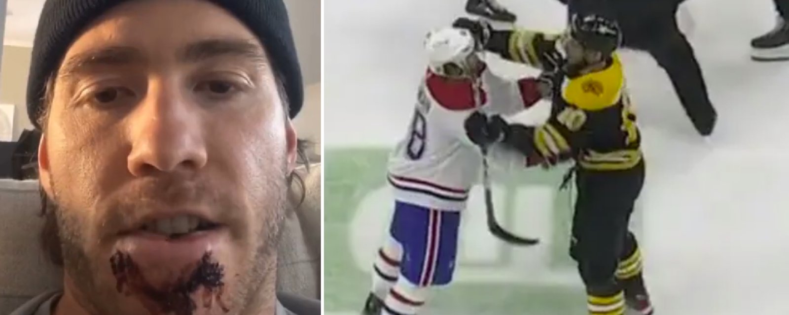 Mike Hoffman réagit à la suspension de A.J. Greer