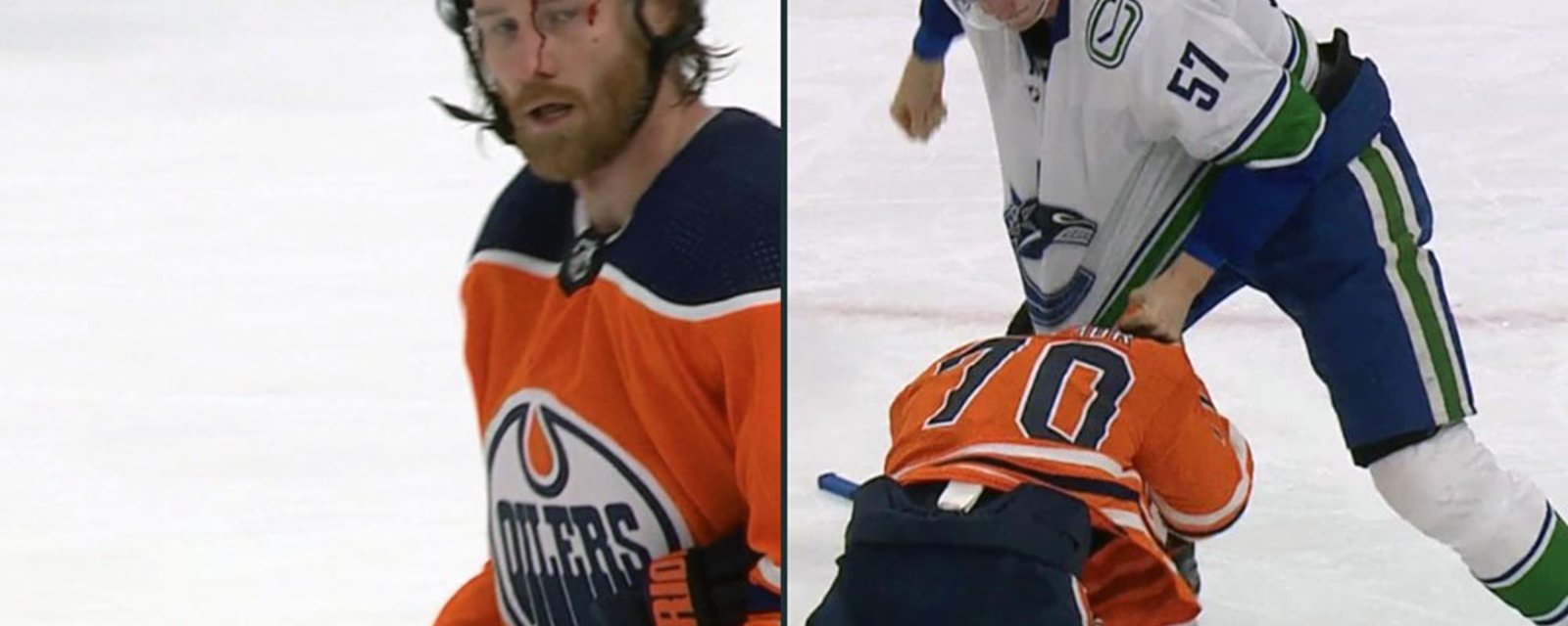 Tyler Myers absolutely obliterates Duncan Keith; fights Colton Sceviour