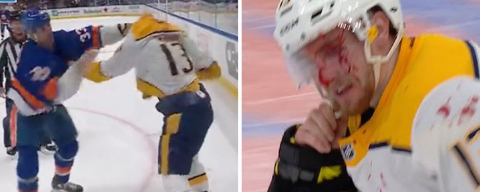 Chara tunes up Trenin, pulls his jersey over his head and leaves him leaking