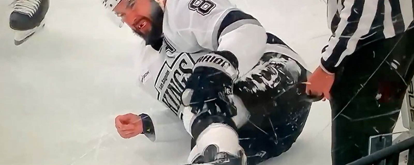 Doughty suffers a devastating injury last night