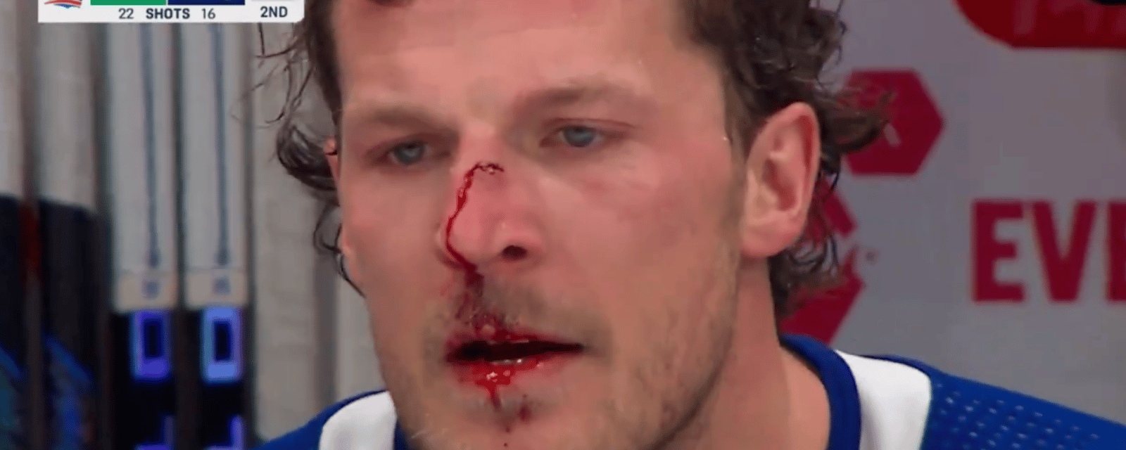 Bloodied Jake McCabe EXPLODES on referees after late blindside hit 