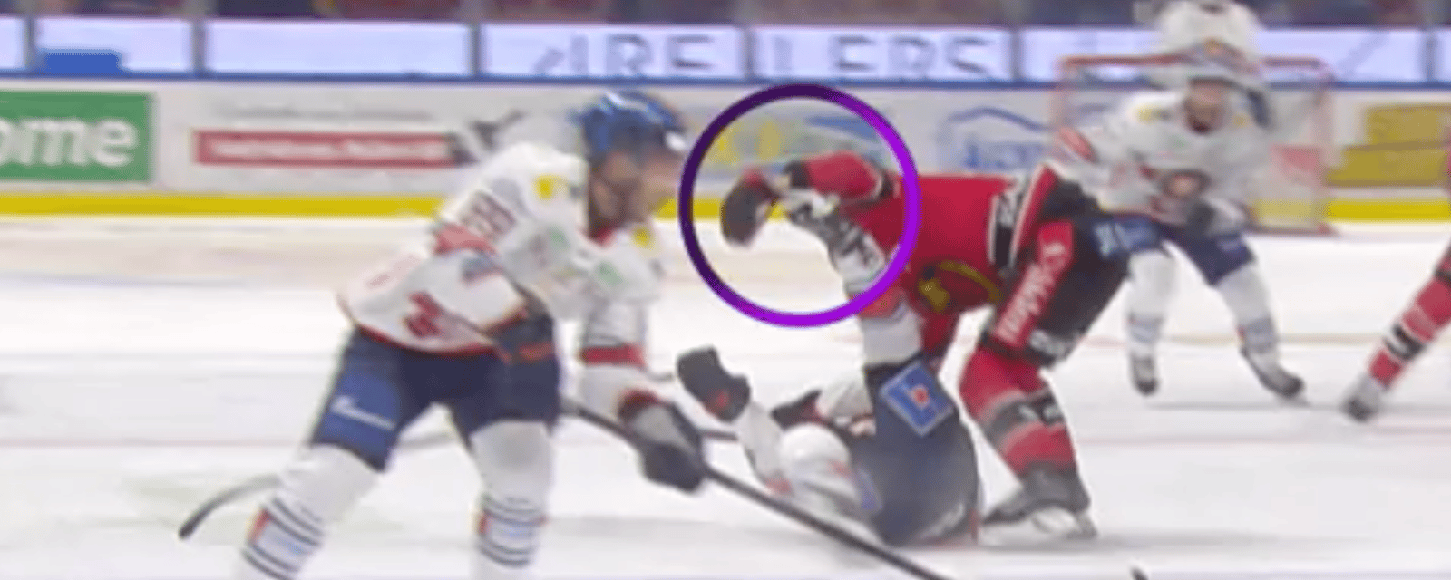 Hockey player suffers another gruesome skate injury 
