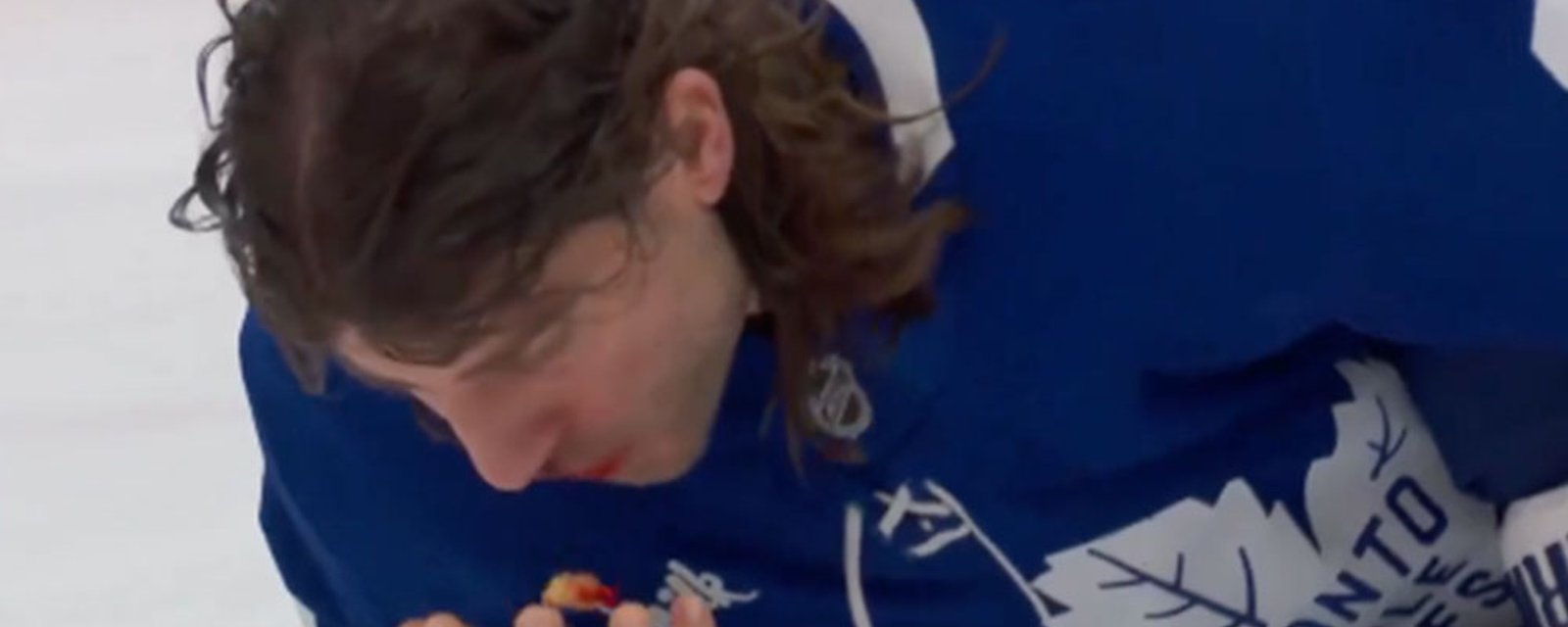 Chris Tanev blocks a shot with his face, spits out mouthful of teeth!