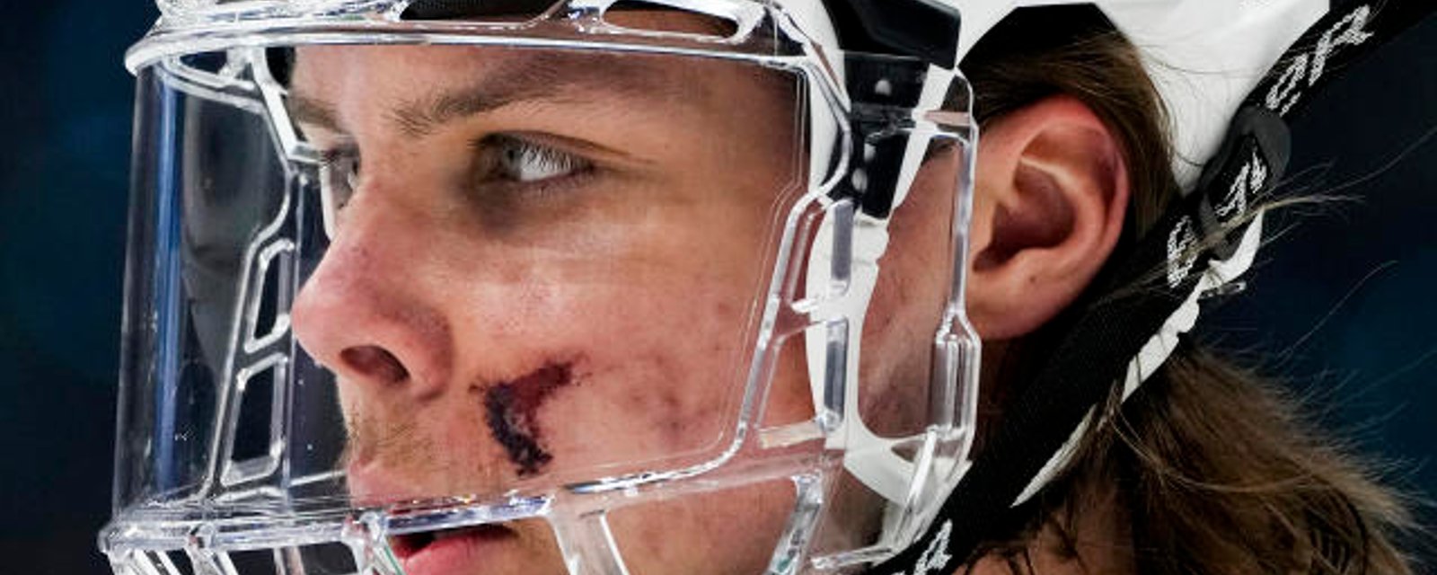 Terrible consequences of Miro Heiskanen’s nasty gash revealed