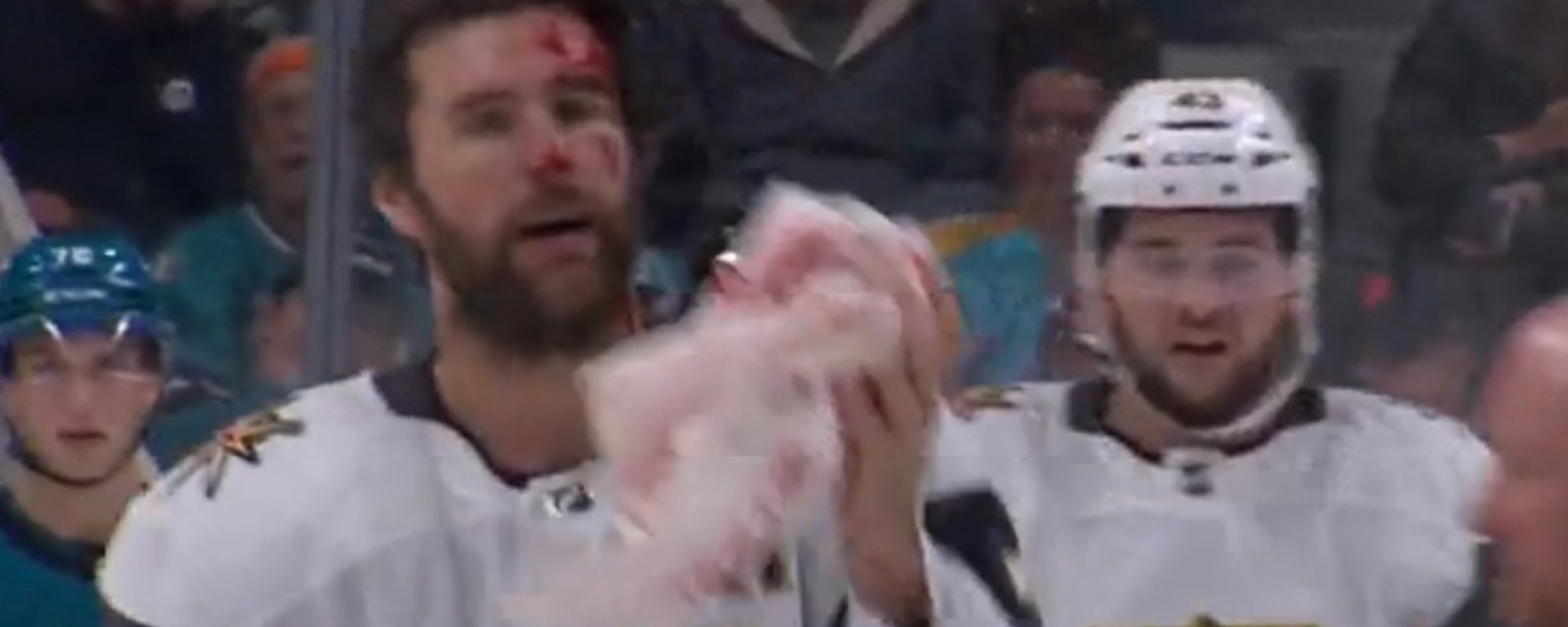 Bloody scene as Alex Pietrangelo takes 90 mph shot to the head!