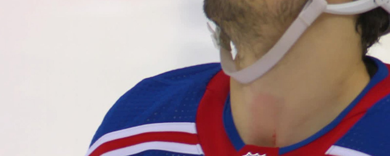 MUST SEE: Rangers F Chris Kreider narrowly avoids horrifying injury