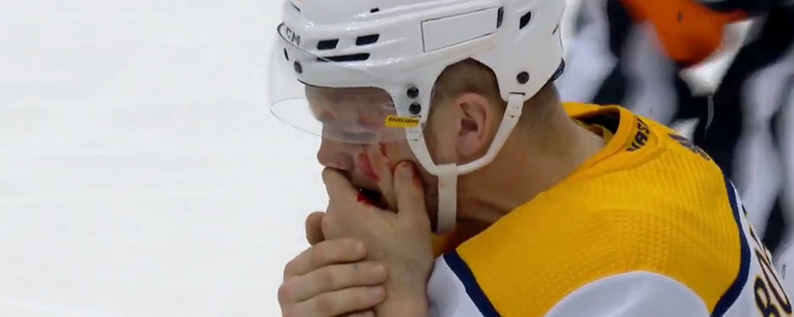Evgeni Malkin crosschecks Mark Borowiecki in the face.