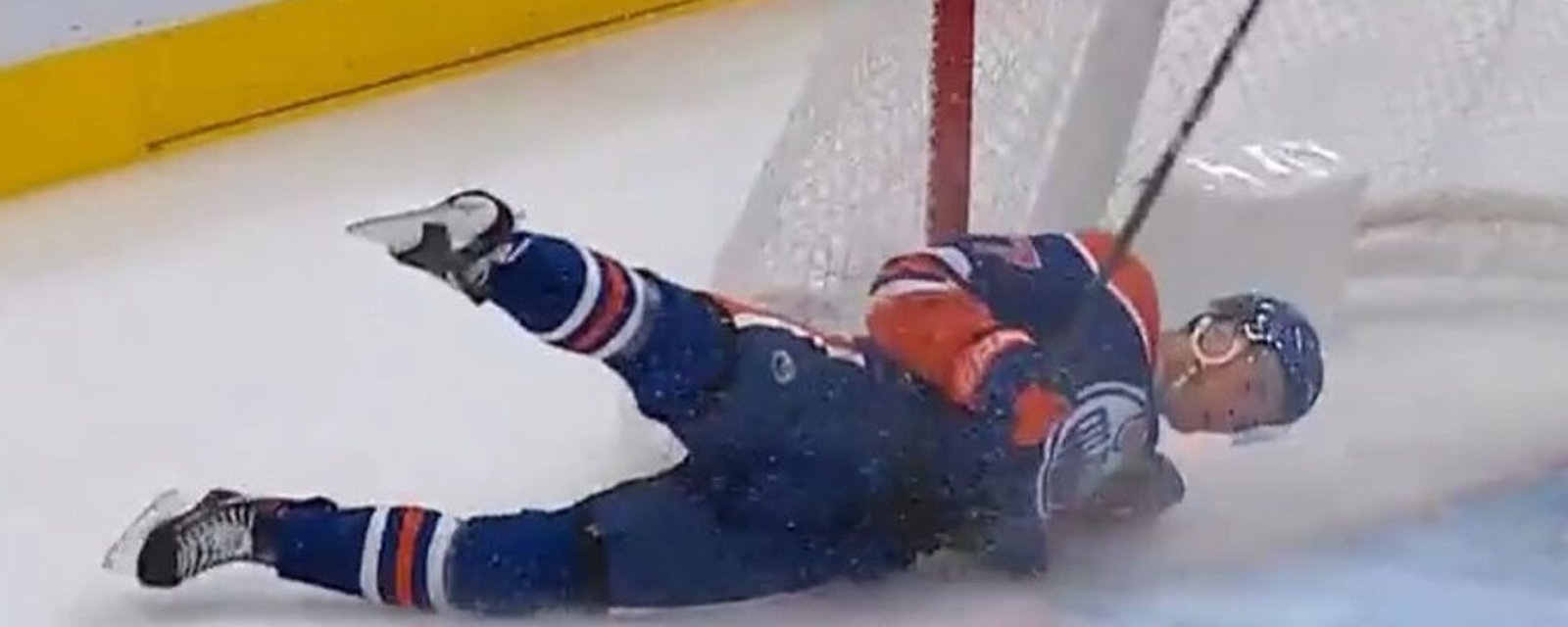 Connor McDavid gets tricked into revealing more about his injury