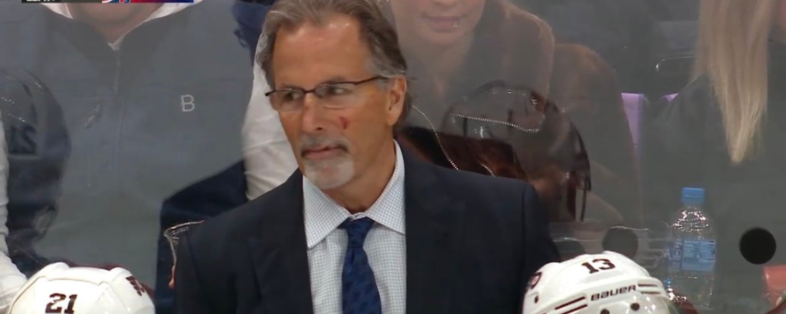 Hilarious theories emerge from John Tortorella’s brutal facial injury 