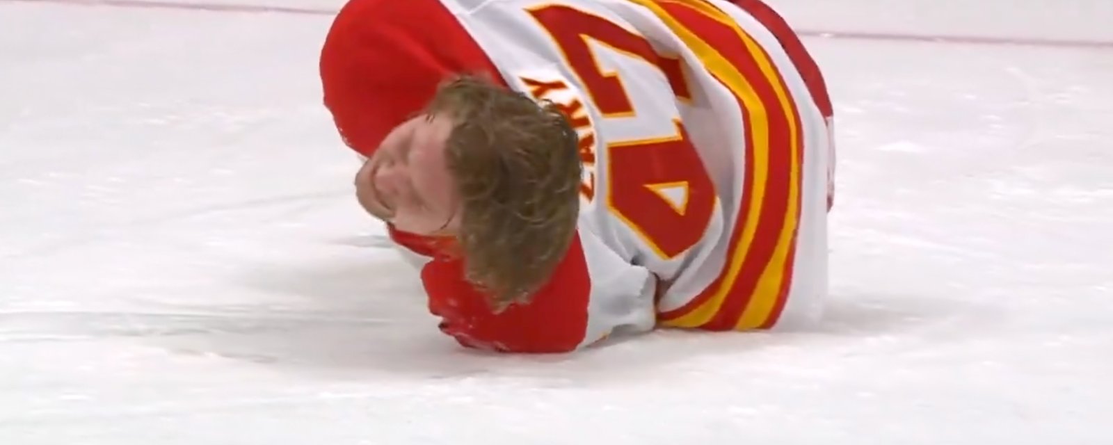 Flames’ Connor Zary suffers most gruesome knee-on-knee injury in front of his mother