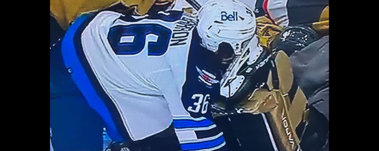 Barron goes face first into skate, gets cut wide open