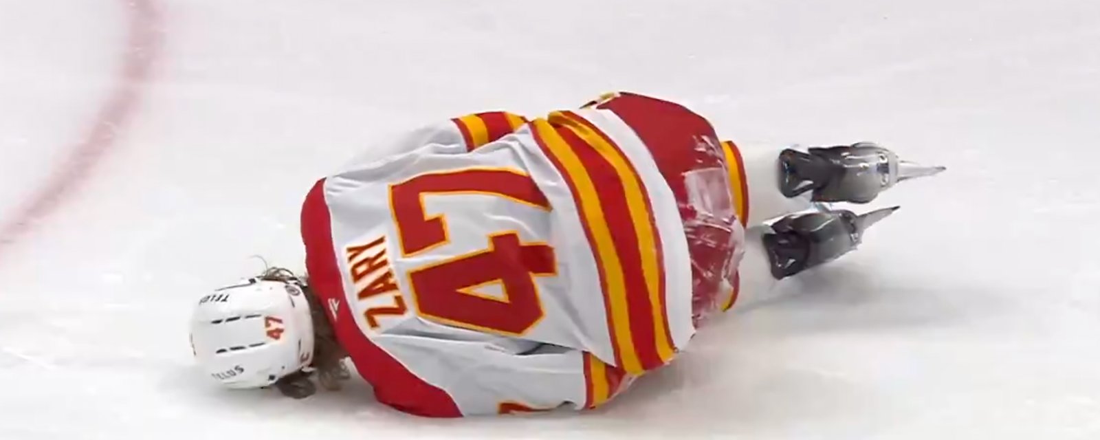 Unimaginable update on Flames’ Connor Zary following gruesome knee injury