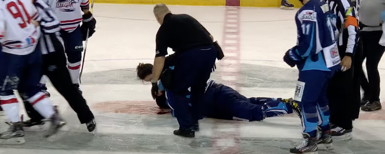 Fight turns into blood bath as both players are rushed to the hospital in LHSAAAQ!