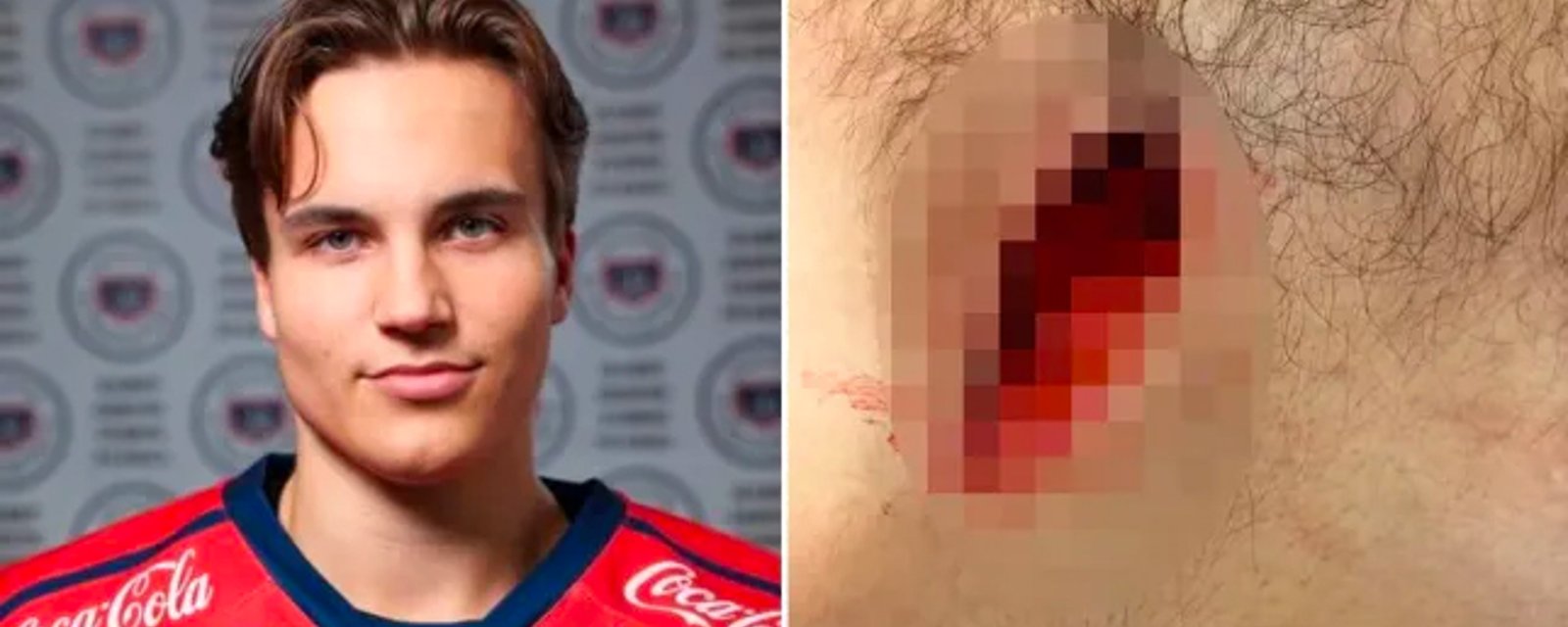 19-year-old D-man has chest slashed open just weeks after Adam Johnson’s death