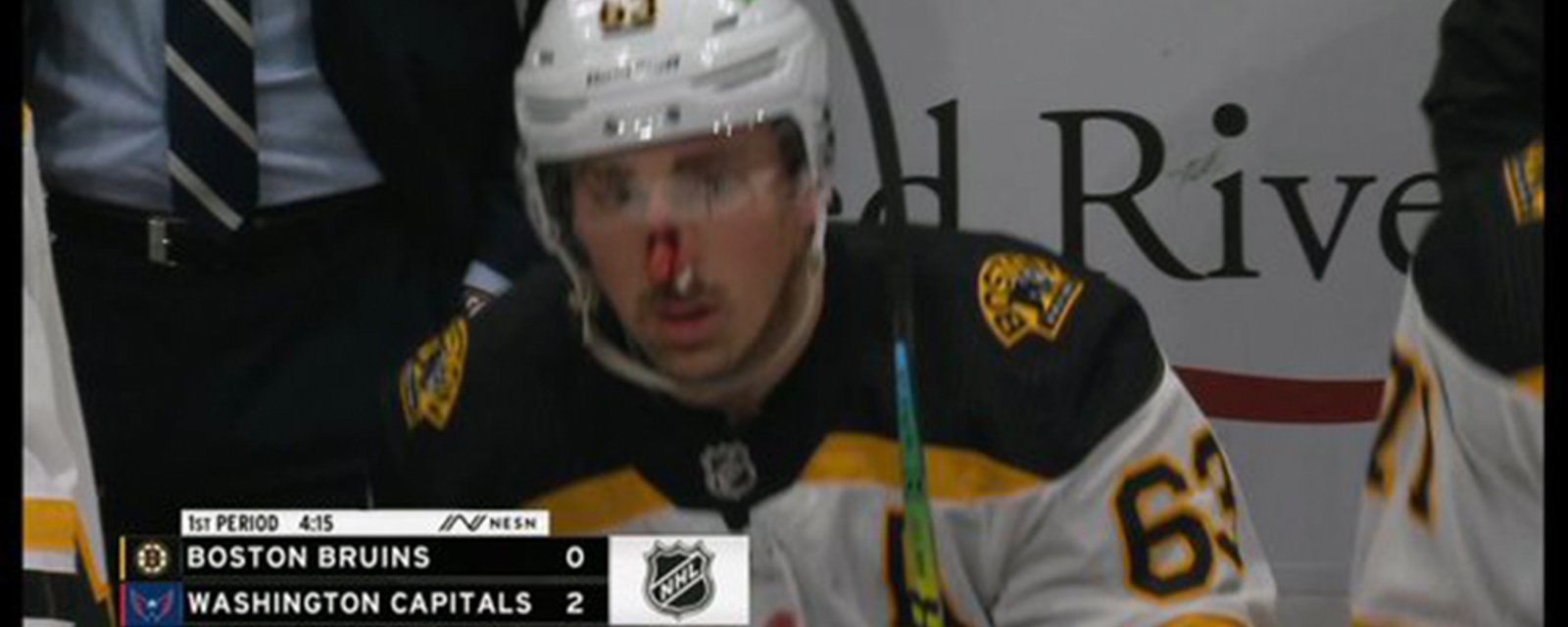 Marchand takes a high stick to the face, gets busted wide open