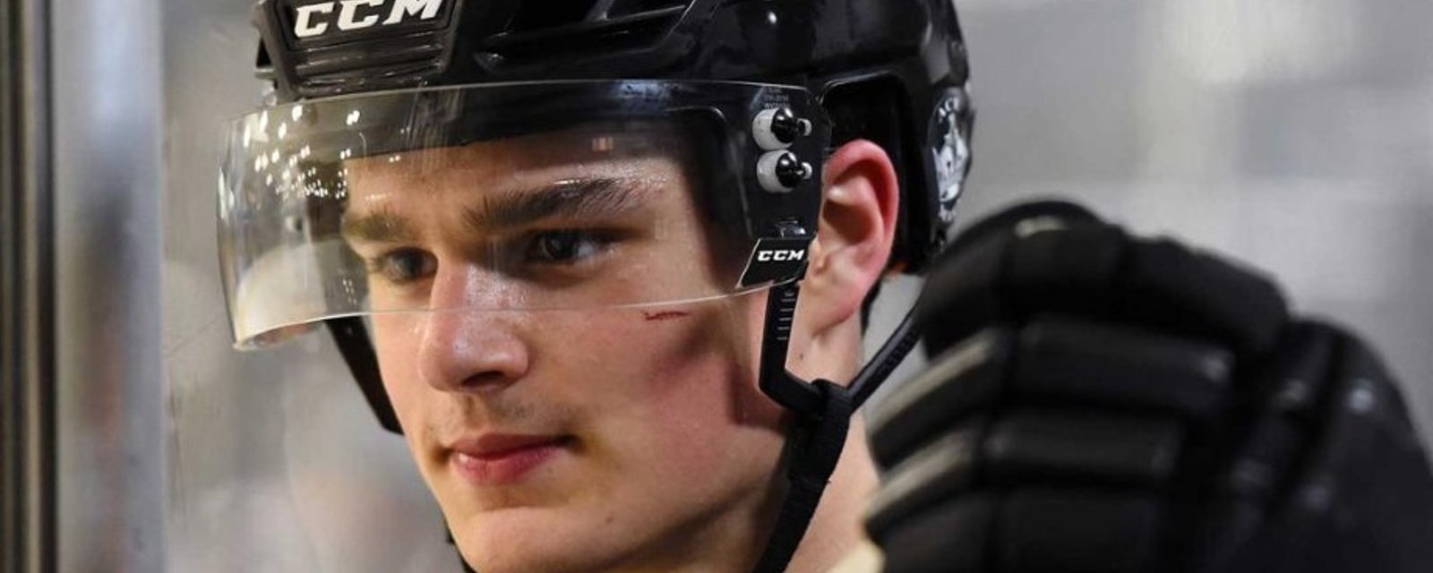 The worst is confirmed for Kings’ Alex Turcotte