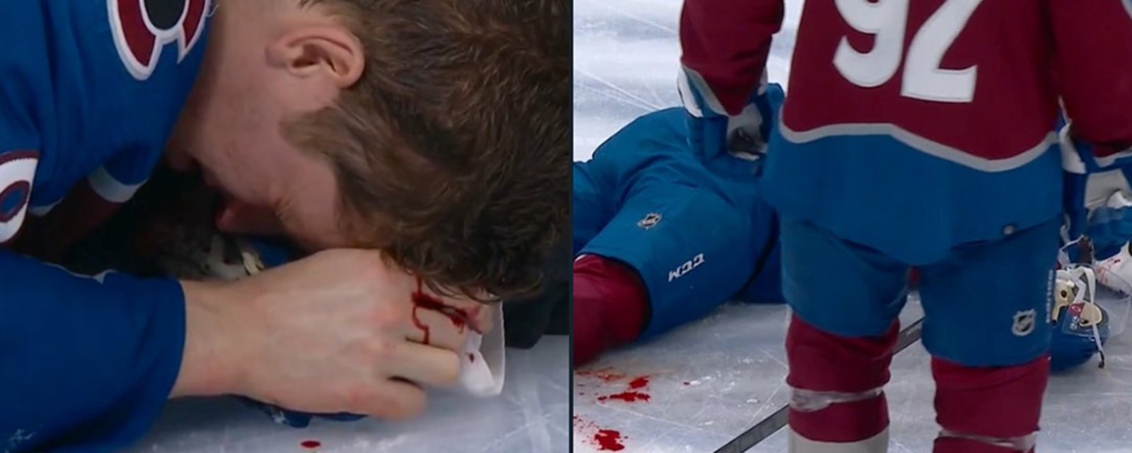 The gruesome aftermath of Hall's hit on MacKinnon