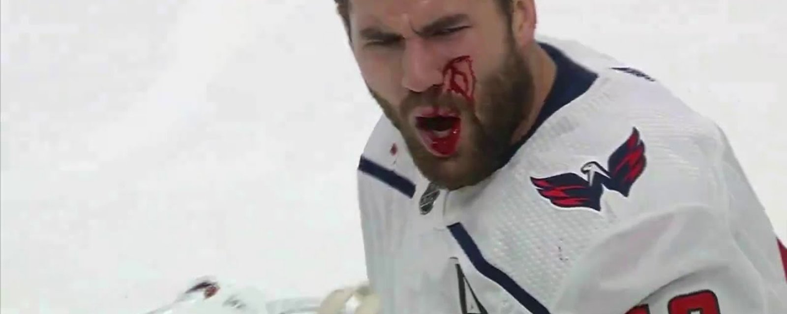 Tom Wilson still blowing blood out of his nose ahead of tomorrow’s game