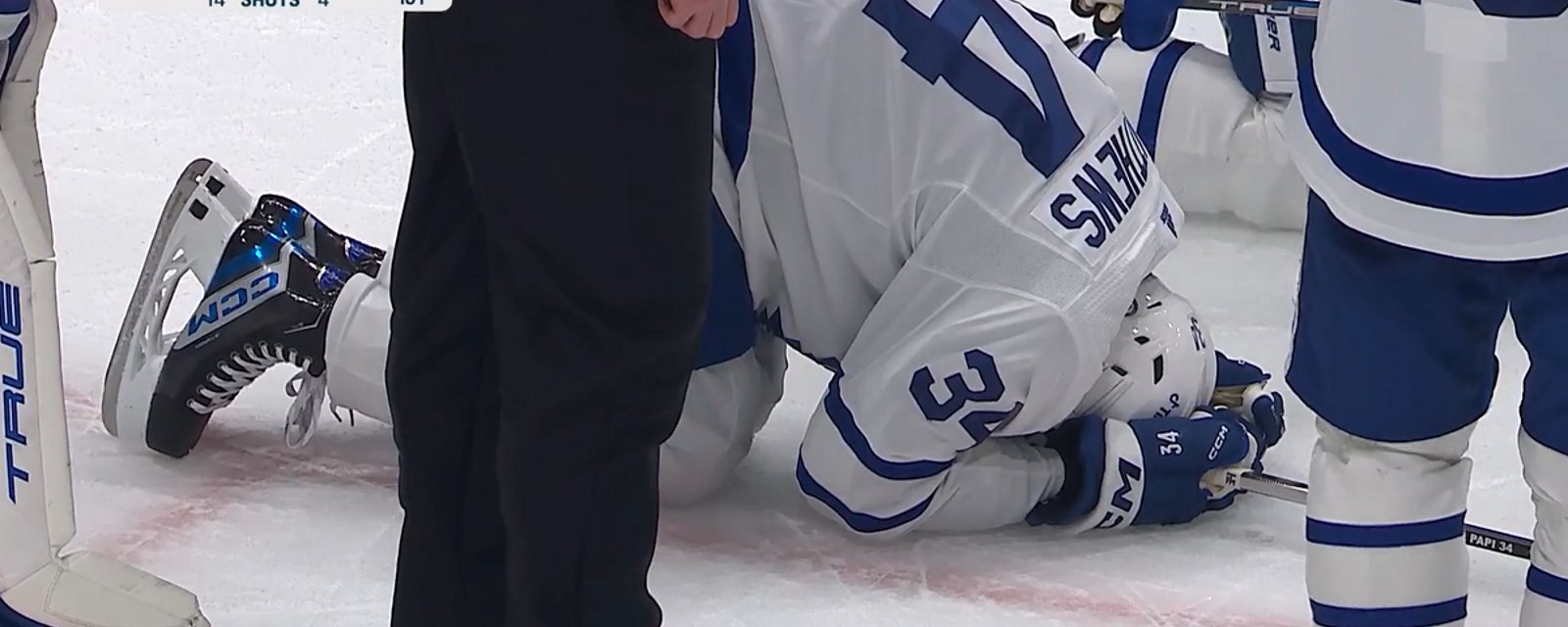 Auston Matthews hurt after blocking a shot on Saturday.