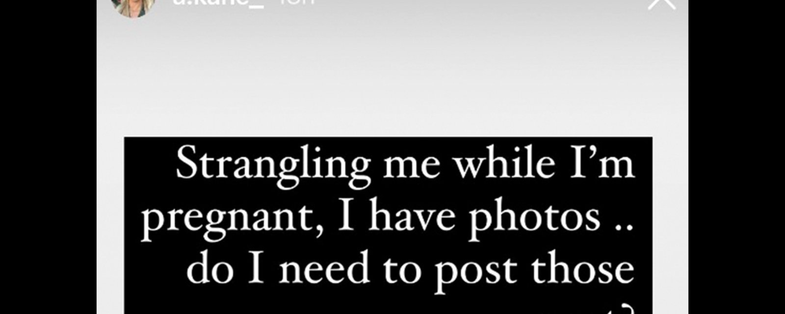 Evander Kane's ex-wife posts disturbing photos, accuses him of strangling her while she was pregnant