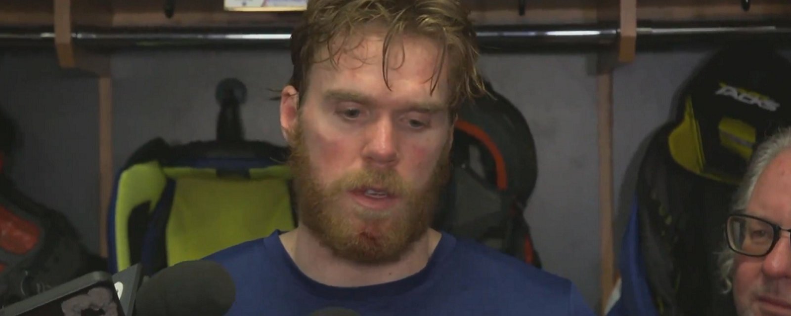 McDavid gives unbelievable excuse for loss in Game 1.