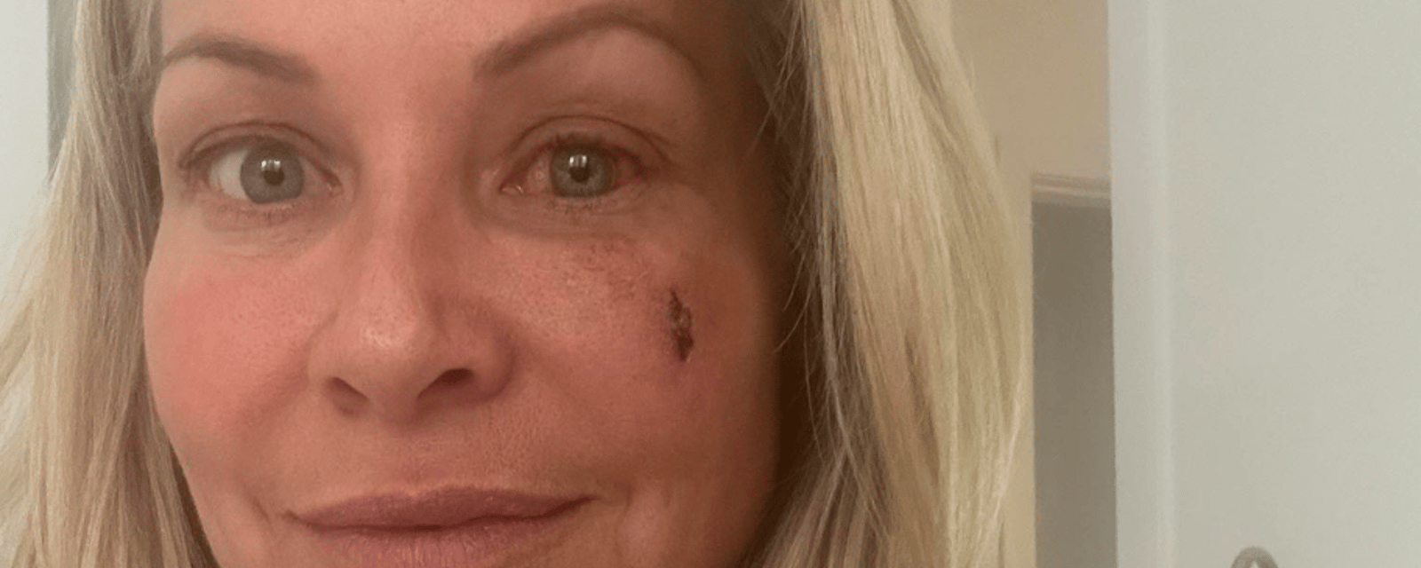 Katherine Huet atteinte de graves séquelles après sa blessure à survivor québec