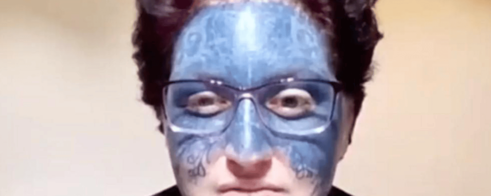 Une femme qui a été tatouée au visage contre son gré reçoit une aide inespérée.