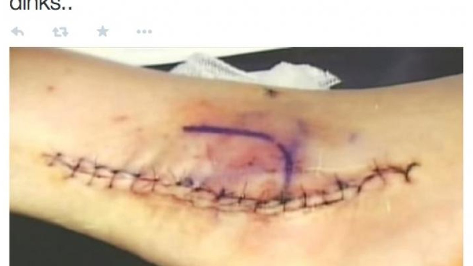 Curt Schilling tweets ghastly photo of &amp;quot;Bloody Sock&amp;quot; ankle. (PHOTOS)